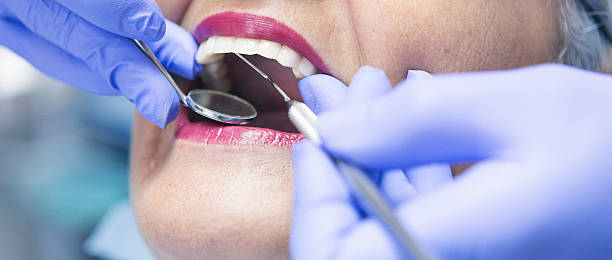Best Knocked-Out Tooth Emergency  in Lake Mills, WI